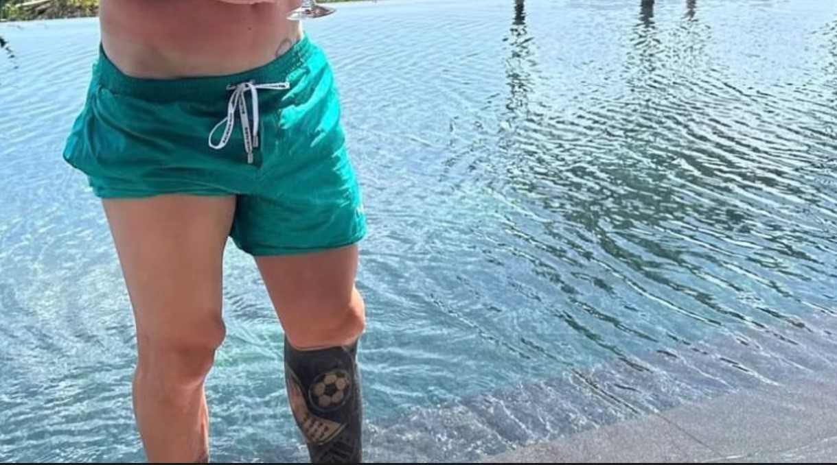 Sáng tỏ lý do đầu gối của Leo Messi bị sưng phù, sự thật khiến fan 'ngã ...