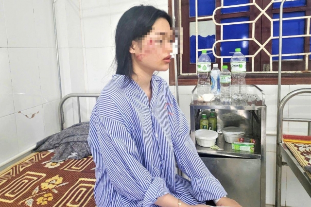 Hành khách kể phút giây kinh hoàng trong vụ lật xe khách tại Hà Tĩnh: “Kính vỡ tung, người nằm chồng lên nhau” 671995