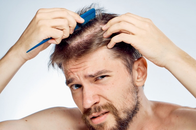 Nam giới có nên gội đầu thường xuyên