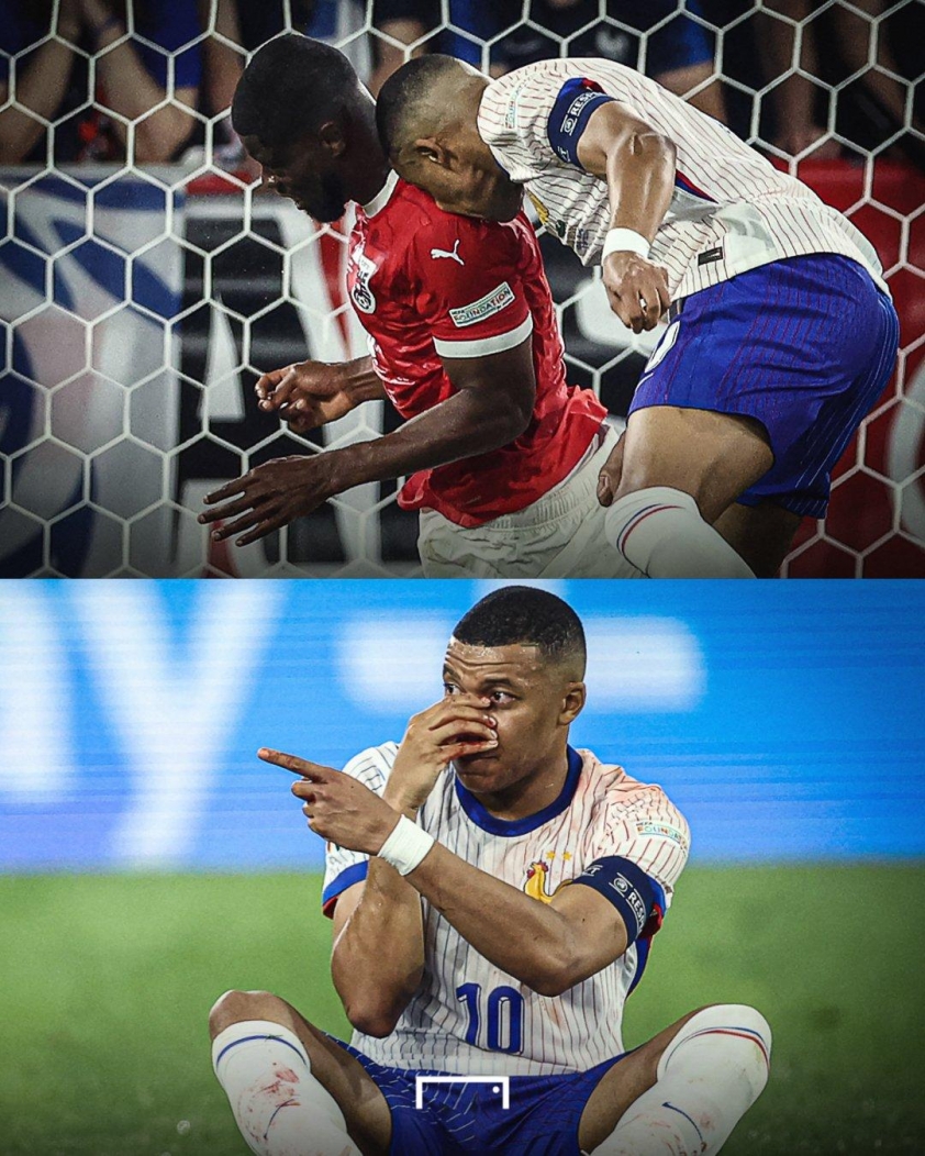 Chính thức: Deschamps xác nhận Mbappe phải phẫu thuật 483777