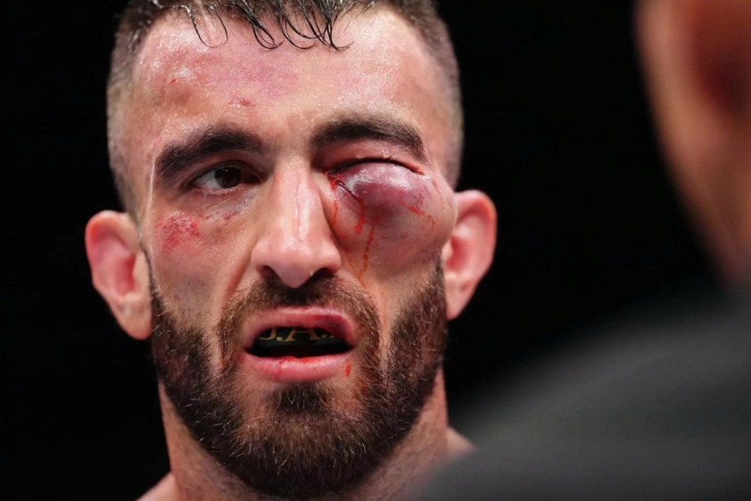 Võ sĩ gốc Việt khiến đối thủ 'biến dạng', lập kỉ lục UFC 673487