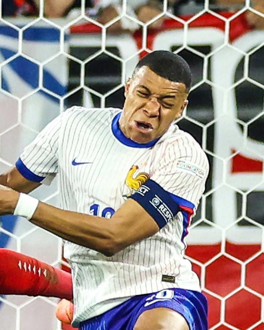 Cận cảnh chấn thương gãy mũi của Kylian Mbappe 482750