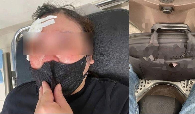 Tấn công phụ nữ giữa phố bằng dùi cui: Người đàn ông Hà Nội đối diện mức phạt ra sao? 633447
