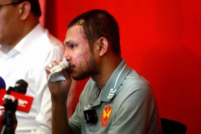 ‘Ronaldo Malaysia’ tái sinh: Từ nạn nhân bị tạt axit đến người loại CAHN 786832