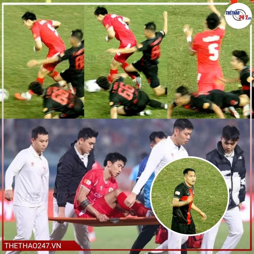 Chấn thương dây chằng: Nỗi lo của 'thế hệ vàng' Việt Nam 6 623814425_1370298215140173_266728312086938578_n-69800a55d6f59