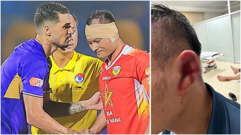 Hoàng Hên vô tình làm chấn thương nặng trò cưng của HLV Park Hang-seo 4 Hoàng Hên vô tình gây chấn thương nặng cho trò cưng HLV Park Hang Seo 732560