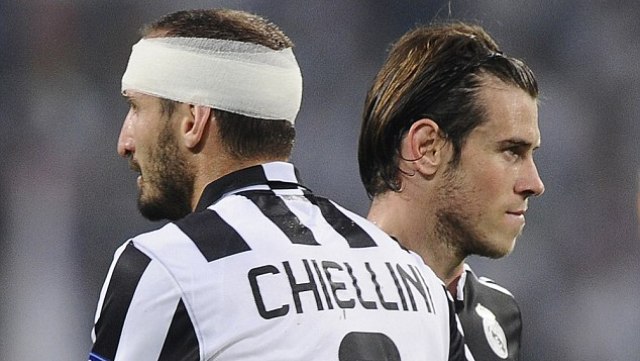 VIDEO: Tình huống va chạm khiến sao Juventus đổ máu