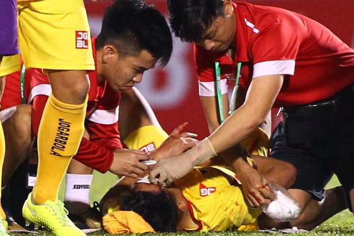 Cựu tuyển thủ U23 Việt Nam phải nhập viện khâu 15 mũi