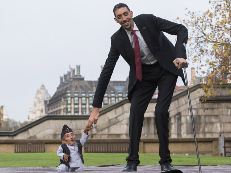 Tại sao người cao nhất thế giới cần dùng 'nạng' để đi?