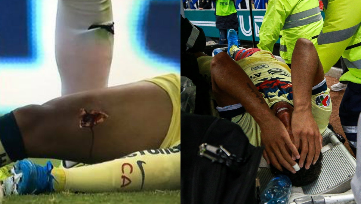 Cựu sao Barca dính chấn thương kình hoàng tại quê nhà