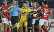 Thủ môn TP HCM húc đầu khiến trọng tài V-League gãy răng