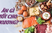 Top 8 thực phẩm tốt cho xương khớp giảm đau nhức hiệu quả