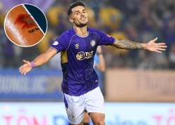 Hoàng Hên 'bật mí' ý nghĩa của hình xăm đặc biệt