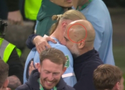 Pep Guardiola lại xuất hiện với vết xước trên đầu