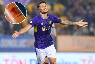 Hoàng Hên 'bật mí' ý nghĩa của hình xăm đặc biệt