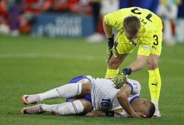 Xong! Ngã ngũ vụ Mbappe gãy mũi nguy cơ chia tay Euro 2024