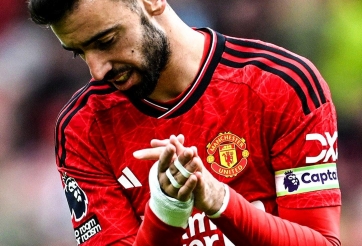 Bruno lần đầu nghỉ đá vì chấn thương, MU lập tức thua đau