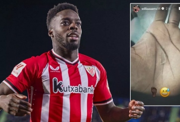 Sao La Liga thi đấu 2 năm với mảnh thủy tinh ở chân mà không hay biết