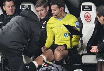 Sự cố hy hữu, trọng tài vĩ đại nhất Bundesliga đứt dây chằng dù không va chạm với ai