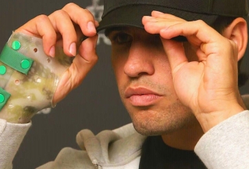 Alcaraz nguy cơ nghỉ thi đấu lâu hơn dự kiến