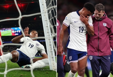 Ngôi sao ĐT Anh đối mặt với chấn thương kinh hoàng