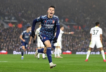 Cơn đau đầu dễ chịu của Mikel Arteta