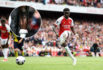 NHM Arsenal phẫn nộ với hình ảnh Saka bị kê chân và đối thủ thoát thẻ