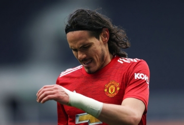 Edinson Cavani khiến MU thiệt đơn thiệt kép
