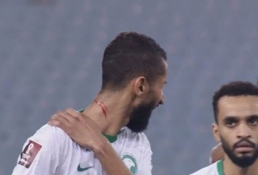 Cầu thủ Ả Rập Xê Út phải vào viện sau pha phạm lỗi của sao HAGL