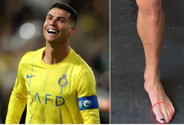 Ronaldo gây sốt vì sơn móng chân như con gái, ngủ trưa 5 lần một ngày