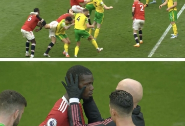 Ngày thi đấu đáng quên của Pogba: Bị Maguire đá chảy máu đầu, bị fan MU la ó và hắt hủi