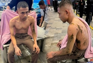 Tình trạng mới nhất của ngôi sao số 1 ĐT Malaysia bị tạt axit