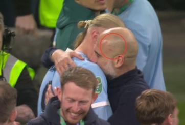Pep Guardiola lại xuất hiện với vết xước trên đầu