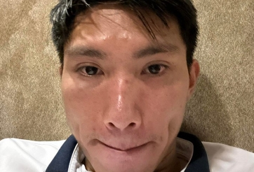 Văn Hậu: 'Tôi bị đánh nguội đến sưng mắt'