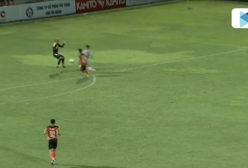 Thanh Bình bị gãy chân, nghỉ hết mùa giải V-League 2022