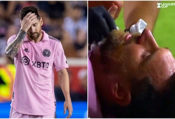 Bước vào 'chảo lửa', Inter Miami công bố luôn tình trạng của Messi