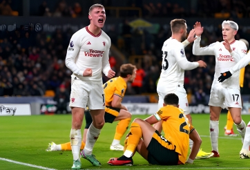 Thỏa thuận của cầu thủ MU cho phép 'nạt nộ' nhau thoải mái trên sân