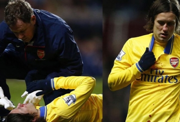 Bị vỡ mũi, Rosicky vắng mặt tại trận gặp Fulham