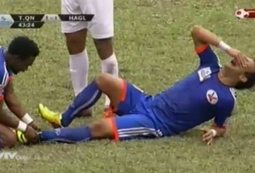Video bóng đá: Cận cảnh chấn thương 'rùng rợn' của cầu thủ Than Quảng Ninh