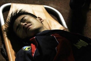 V-League 2014: Thêm một cầu thủ gẫy chân vì lối đá thô bạo