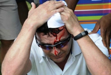 Tiger Woods làm khán giả chảy máu be bét