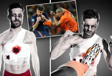 Xabi Alonso vẫn chưa hết ám ảnh cú kung-fu của Nigel de Jong