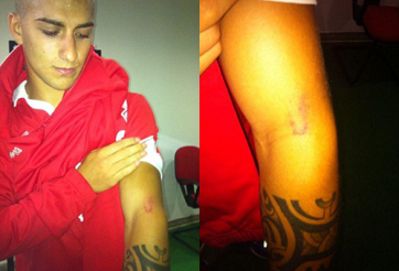 VIDEO: Tiền đạo U21 Italia hung hăng cắn tay đối thủ như Suarez