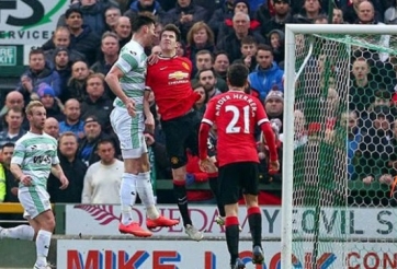 VIDEO: Cận cảnh pha pha chạm khiến Paddy McNair... rách toạc đầu