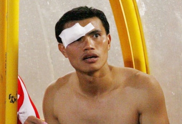 Tài Em phải khâu 6 mũi sau trận hòa 1-1 SLNA