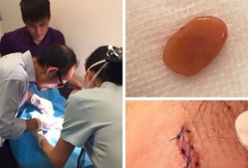 Công Vinh trực tiếp quan sát bác sĩ mổ đầu gối