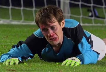 VIDEO: Những tình huống cầu thủ phải dùng mặt chơi bóng bất đắc dĩ