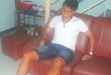 Chấn thương của Anh Khoa là cực kỳ nghiêm trọng