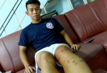 Sốc: Quế Ngọc Hải phải chi đến 1 tỷ đồng viện phí cho Anh Khoa