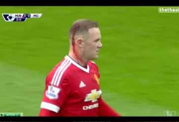 VIDEO: Tình huống va chạm khiến Rooney chảy máu đầu